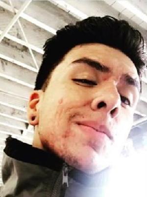 Marvin Hernandez death by force case in Los-angeles, CA