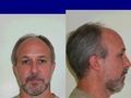 Ralph Belvedere missing person case in Anderson, Indiana